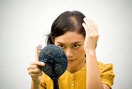 Что такое диффузное выпадение волос?