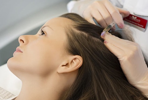 Процедура мезотерапии для волос