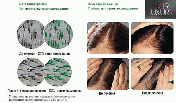 Витамины для волос Пантовигар: инструкция по применению