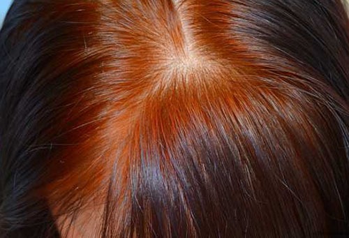 Светлые корни волос